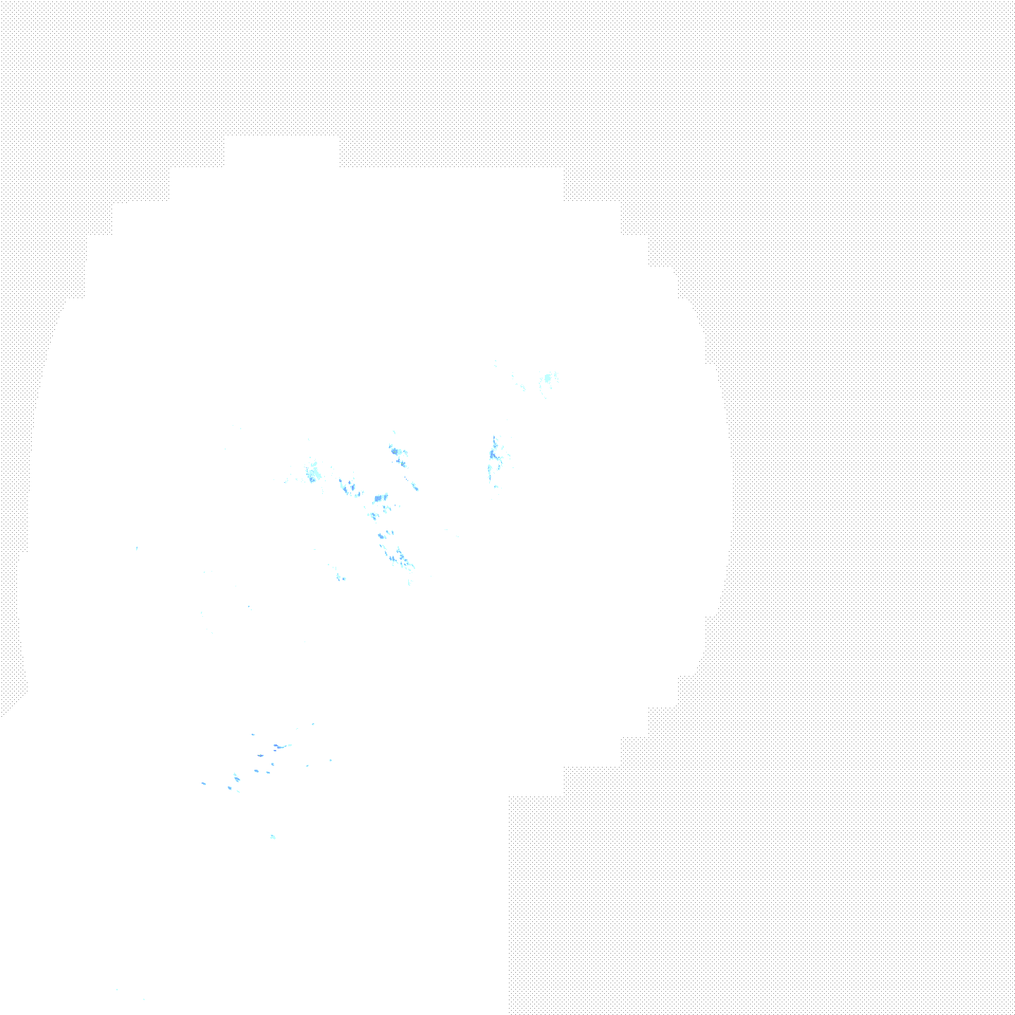 大分 市 雨雲 レーダー